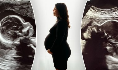 Alabamalı iki rahmi olan kadın, her rahminde bir tane olmak üzere ikizlere hamile: '50 milyonda 1' şans