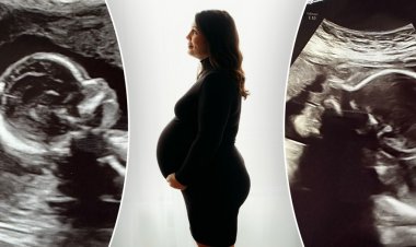Alabamalı kadının mucizevi hamileliği, göbek yağı-demans bağlantısı ve en yeni uyku trendleri